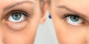 Mit Augentransplantationen zukünftig zu gesunden Augen
